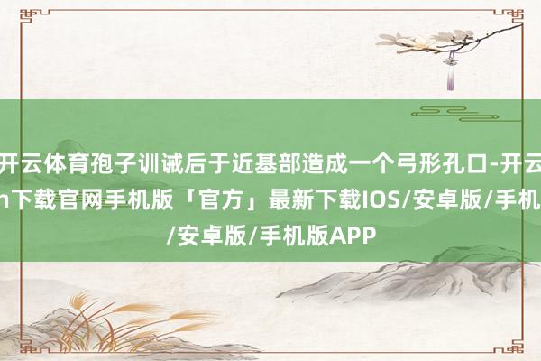 开云体育孢子训诫后于近基部造成一个弓形孔口-开云kaiyun下载官网手机版「官方」最新下载IOS/安卓版/手机版APP