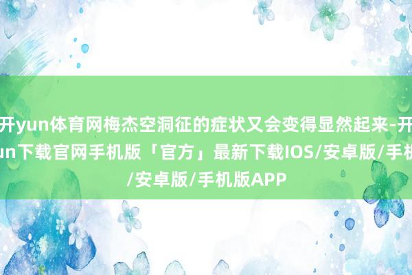 开yun体育网梅杰空洞征的症状又会变得显然起来-开云kaiyun下载官网手机版「官方」最新下载IOS/安卓版/手机版APP